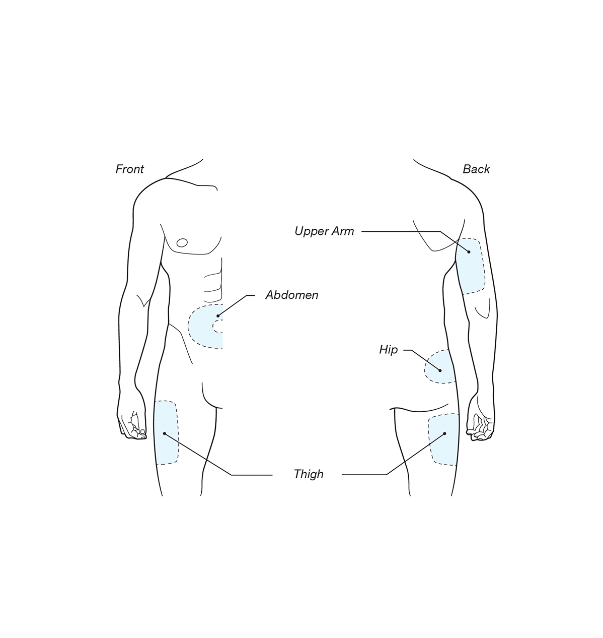 Subcutaneous injection instructions of where to inject